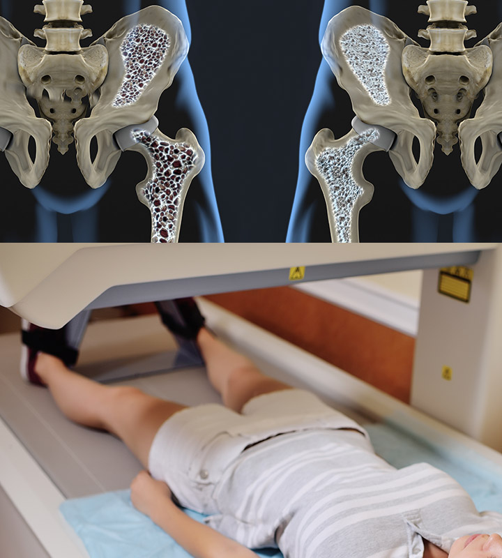Osteoporosis Centre