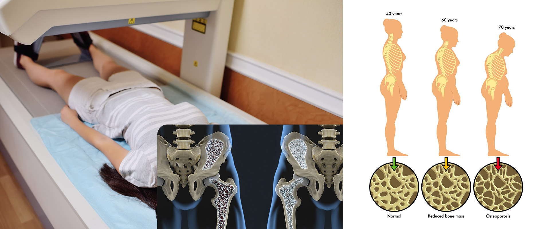 Osteoporosis Centre