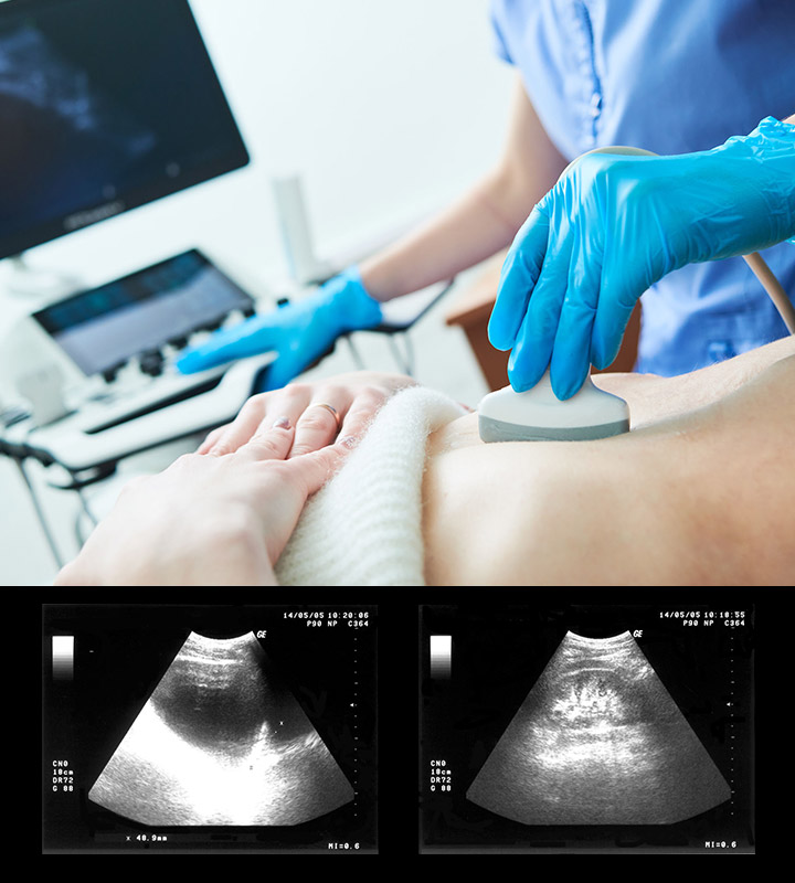 Ultrasound