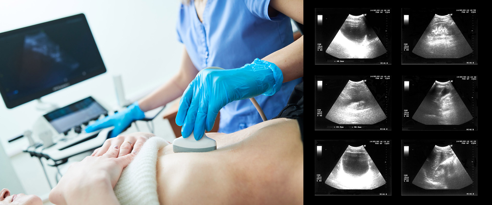Ultrasound